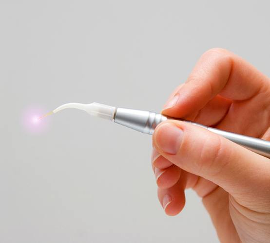 Hand holding soft tissue laser dentistry tool