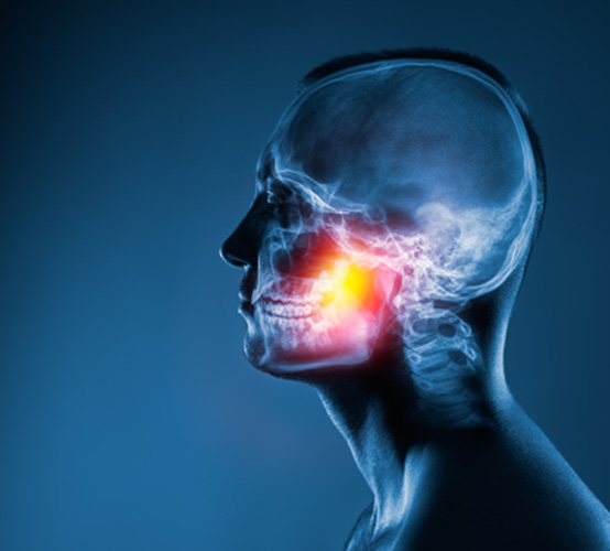 an X-ray-type image of a man showing his skull and jaw joints