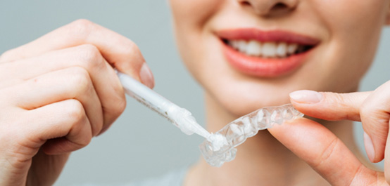Woman applying whitening gel to applicator tray