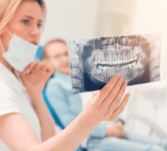 a dentist holding an X-ray of a patient’s wisdom teeth