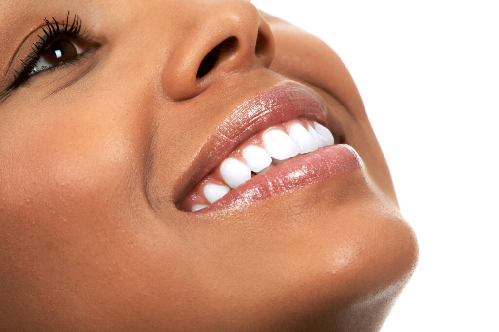 3/4 profile view of woman with bright teeth smiling looking upward